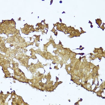 CTNNB1 Antibody