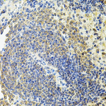 RALBP1 Antibody, KO Validated