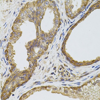 EGFR Antibody, KO Validated