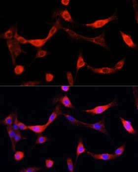 EGFR Antibody, KO Validated