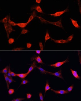 EGFR Antibody