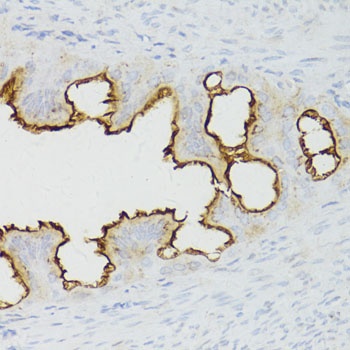 EGFR Antibody