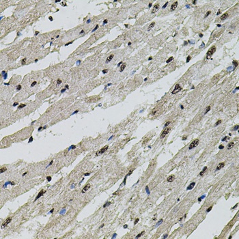 beta Catenin Antibody, KO Validated