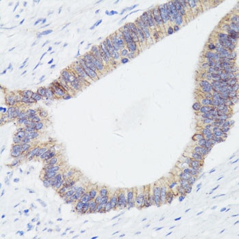 CTNNB1 Antibody