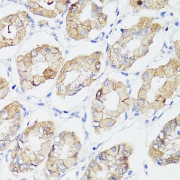 beta Catenin Antibody, KO Validated