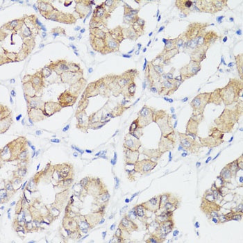 CTNNB1 Antibody