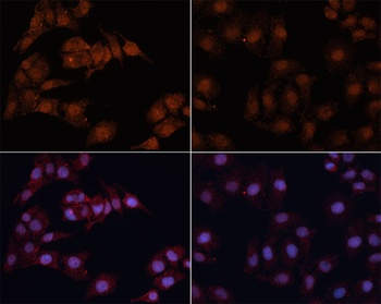 MAP1LC3B Antibody