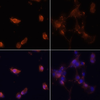 MAP1LC3B Antibody