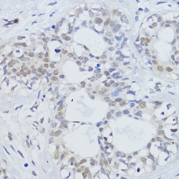 SIRT1 Antibody, KO Validated