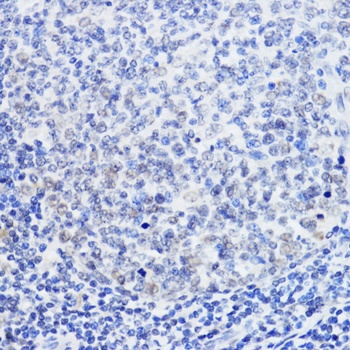 SIRT1 Antibody, KO Validated