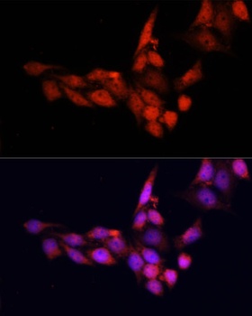 SIRT1 Antibody, KO Validated