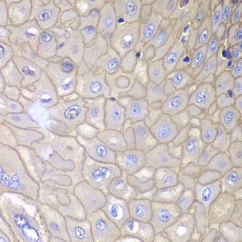 ANXA1 Antibody, KO Validated