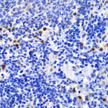 ANXA1 Antibody, KO Validated