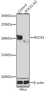 ROCK1 Antibody, KO Validated