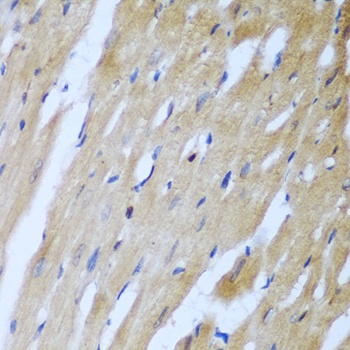 ROCK1 Antibody, KO Validated