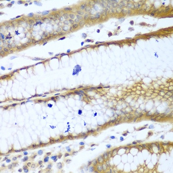 ROCK1 Antibody, KO Validated