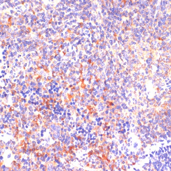 ROCK1 Antibody, KO Validated