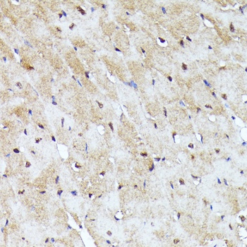YAP1 Antibody, KO Validated