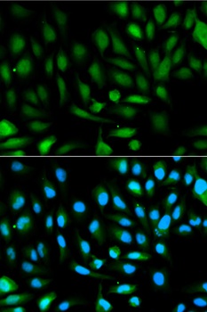 PARK7 Antibody, KO Validated