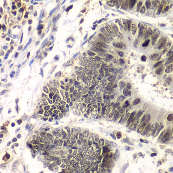 SMARCA4 Antibody