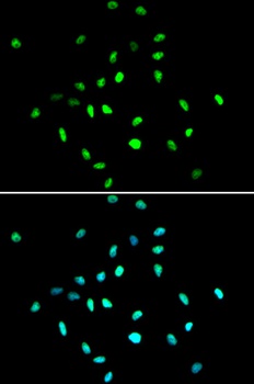 HDAC1 Antibody, KO Validated
