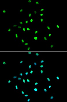 HDAC1 Antibody