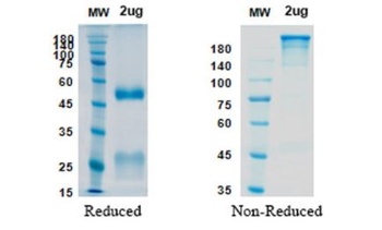 Recombinant SARS-CoV-2 (COVID-19) RBD Neutralizing antibody [AbA128]