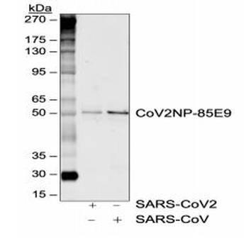 SARS-CoV-2 (COVID-19) Nucleocapsid Antibody [85E9]