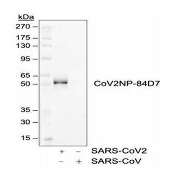 SARS-CoV-2 (COVID-19) Nucleocapsid Antibody [84D7]