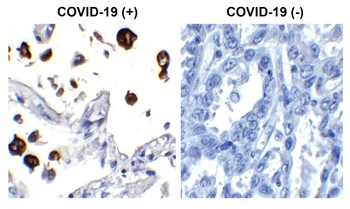 SARS-CoV-2 (COVID-19) Nucleocapsid Antibody [84C4a]