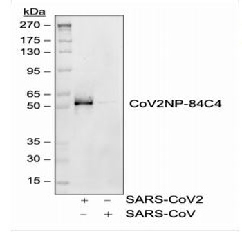 SARS-CoV-2 (COVID-19) Nucleocapsid Antibody [84C4a]