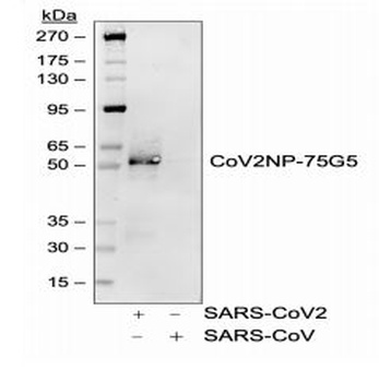 SARS-CoV-2 (COVID-19) Nucleocapsid Antibody [75G5a]