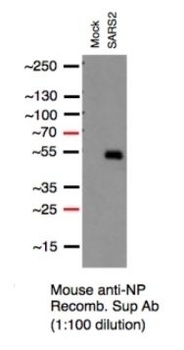 SARS-CoV-2 Nucleocapsid Antibody