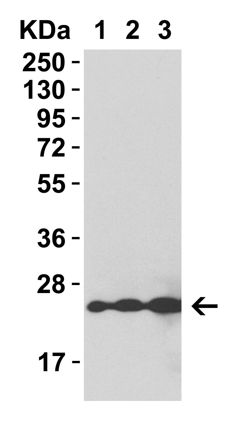 HIV-1 p24 Recombinant Protein