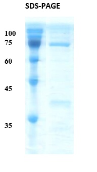Treponema pallidum (Syphilis) p15/p17/p47 Fusion Recombinant Protein