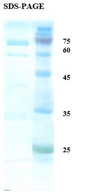 Rubella virus E2 Recombinant Protein