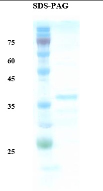 Rubella virus E1 Recombinant Protein
