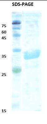 Trypanosoma cruzi chimeric chagas Recombinant Protein