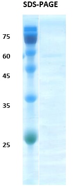 HIV-2 Gag p26 Recombinant Protein
