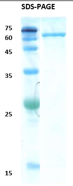 Hepatitis C virus (HCV) NS3 (383AA) Recombinant Protein