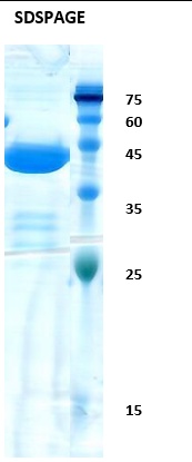 Hepatitis C virus (HCV) NS3 (176AA) Recombinant Protein