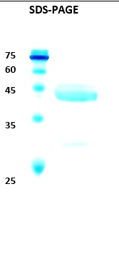 Hepatitis C virus (HCV) NS3 (123AA) Recombinant Protein