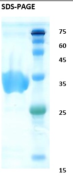 Hepatitis C virus (HCV) NS3 Recombinant Protein
