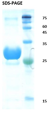 Hepatitis C virus (HCV) core Recombinant Protein