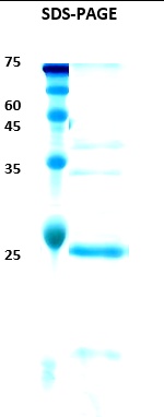 Epstein-Barr Virus (EBV) VCA p18 Recombinant Protein