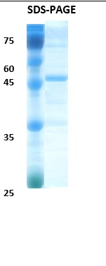 Epstein-Barr Virus (EBV) VCA p18 Recombinant Protein