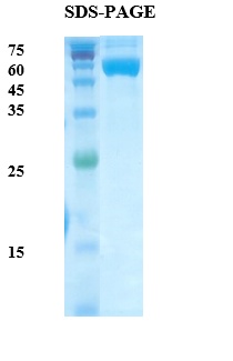 Plasmodium vivax Lactate Dehydrogenase (Pv-LDH) Recombinant Protein