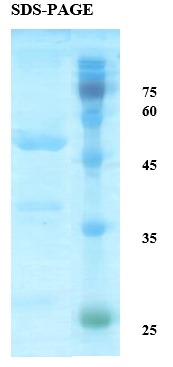 HTLV-2 Envelope gp21 Recombinant Protein