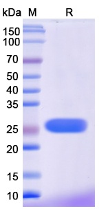 Monkeypox virus/MPXV M1R Recombinant Protein