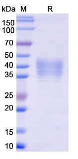 Monkeypox virus/MPXV E8L Recombinant Protein